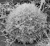 Ebola virus, SEM
