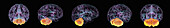 Cerebellum in human brain, illustration