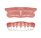 Upper jaw arch and edentulous mould, illustration
