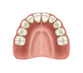 Severely resorbed upper jaw and teeth, illustration