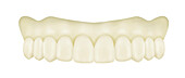 Wax try-in dental prosthesis, illustration