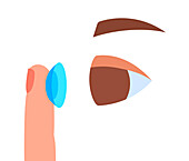 Contact lenses, illustration