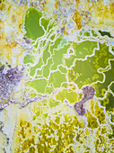 Abstrakte Luftaufnahme der Salz- und Schwefelformationen in Dallol, Äthiopien.