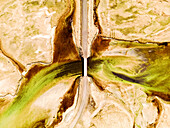 Aerial view of a scenic bridge over a winding road amidst a beautiful landscape and water, Bildudalur, Iceland.
