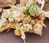 SARS-CoV-2 Omicron variant, SEM