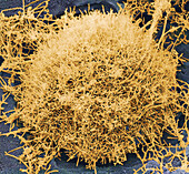 Ebola virus, SEM