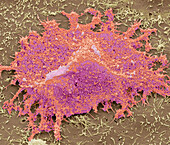 Ebola virus, SEM