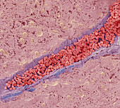 Liver vein, SEM