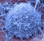 Ebola virus, SEM