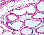 Apocrine sweat glands, light micrograph