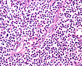 Pus, light micrograph