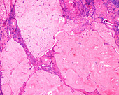 Corpus albicans, light micrograph