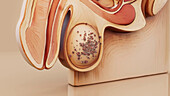 Testicular cancer, conceptual illustration