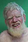 Chandanath hill, Bangladesh - 12 March 2021: View of a man with white hair and beard against a vibrant green backdrop, his face etched with unique character and worn teeth.