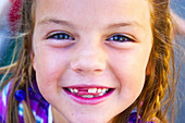 girl missing tooth