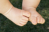 infant feet