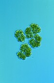 Dictyosphaerium-chlorococcal Algae Optic microscopy