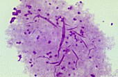 Neisseiria gonorrhoeae bacterium