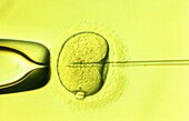 In vitro fertilization Light micrograph of a human egg left injected with a micro-needle right containing a single sperm