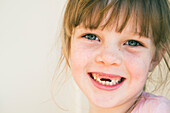 Young girl with missing front teeth, gold coast queensland australia