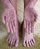 Close-up of Roselle body scrub treatment on hands and feet