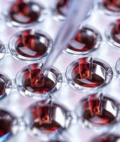 Nahaufnahme von Multi-Well-Platte und Pipette