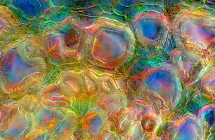 Das Bild zeigt Nesselgewebe im Querschnitt des Stängels, fotografiert durch das Mikroskop in polarisiertem Licht bei einer Vergrößerung von 400X