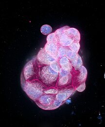 12450656